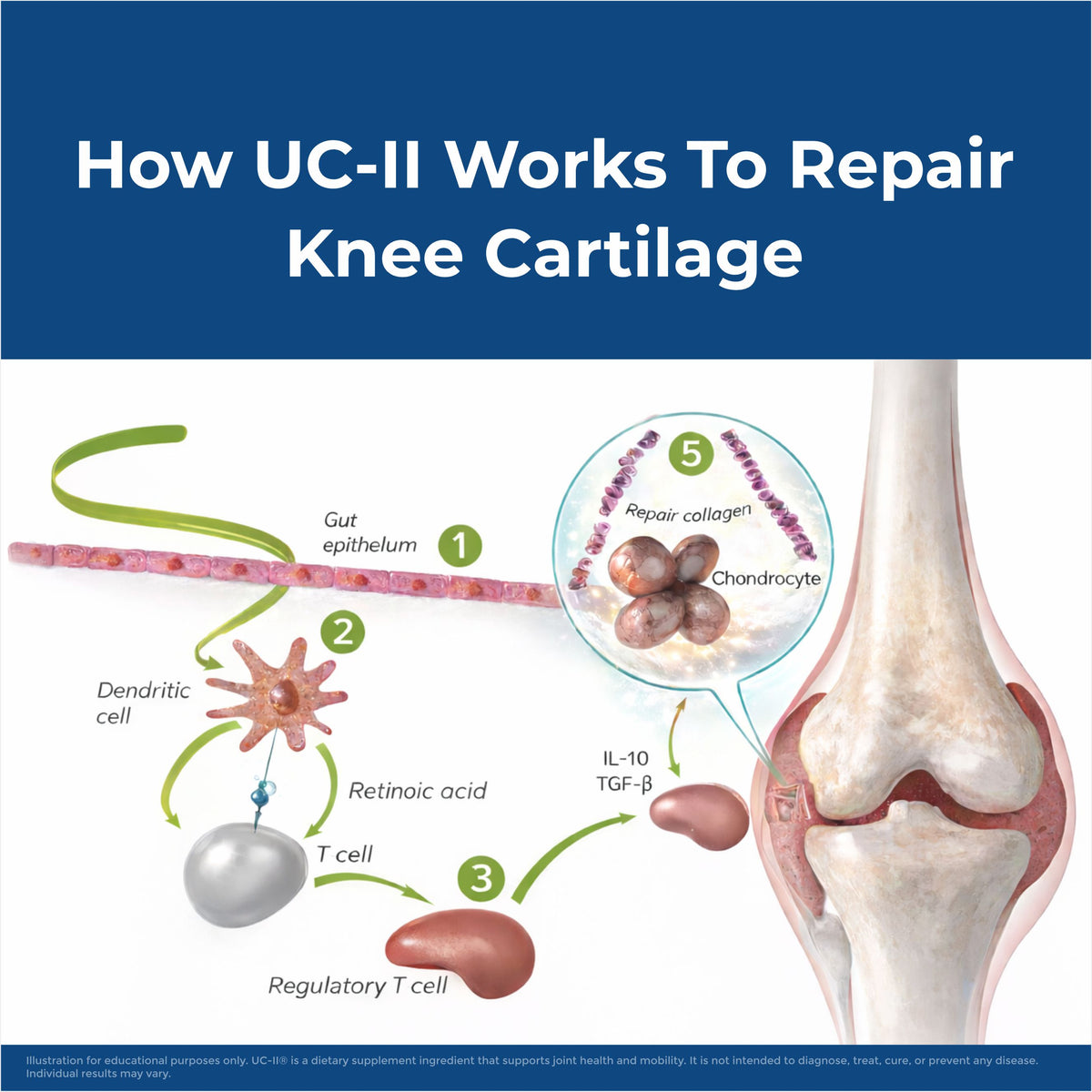 Joint Health – Knee Pain Relief & Cartilage Support