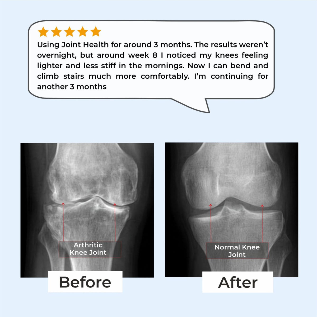 Joint Health – Knee Pain Relief & Cartilage Support